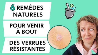 6 remèdes naturels contre les verrues et verrues plantaires résistantes  🌿 [upl. by Longo]