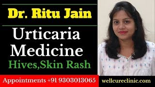 UrticariaHomeopathic Medicine for Urticaria HivesSkin Bumps Rashes Itching Allergic Skin [upl. by Grussing]