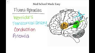 Fluent Aphasias Made Easy How to Distinguish and Remember Them [upl. by Ahsauqal]