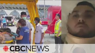 Severe turbulence emergency landing were surreal injured Singapore Airlines passenger says [upl. by Dirrej]