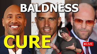 Theres a CURE for male pattern baldness [upl. by Gadmon]