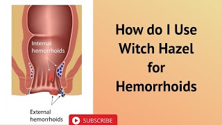 How do I Use Witch Hazel for Hemorrhoids [upl. by Burrton]