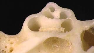 Aclands Video Atlas of Human Anatomy Cochlea [upl. by Abernathy]