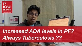 icutalk 1 Does high ADA levels in pleural fluid always means tuberculosis [upl. by Carie]