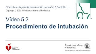 Procedimiento de Intubación Neonatal [upl. by Yul]