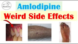 Amlodipine Weird Side Effects Skin Gastrointestinal Psychological [upl. by Bradway627]