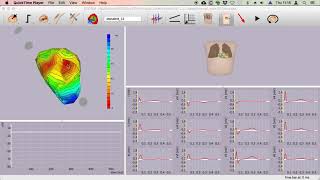 Basic usage of ECGsim [upl. by Asimaj]