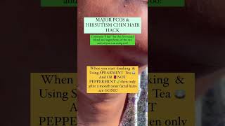 Pcos Hirsutism Hair Reducing Methods Link in bio to shop pcos bundle hirsutism pcossupport [upl. by Aynahs]