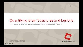 2017 Webinar  Quantifying Brain Structures and Lesions with LesionQuant [upl. by Laven688]