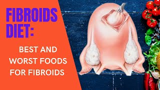 FIBROIDS DIET BEST AND WORST FOODS FOR FIBROIDSCan food help shrink fibroids [upl. by Merdith846]