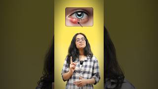 English Vocabulary For Skin Conditions  Medical Words learnenglish ananya esl englishspeaking [upl. by Airdnek]