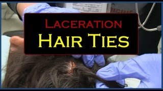 Laceration Hair Ties [upl. by Guillema]