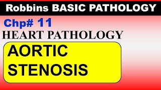 Chp11 Robbins Patho  Heart Pathology  Calcific Aortic Stenosis  Dr Asif Lectures [upl. by Goddard668]