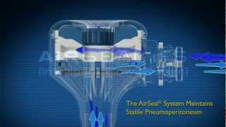 SurgiQuest How AirSeal Works [upl. by Akenn367]