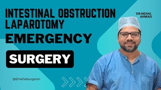 Intestinal obstruction laparotomy doctor laparoscopicsurgeon emergency ytviralyoutubevideo [upl. by Enomaj217]