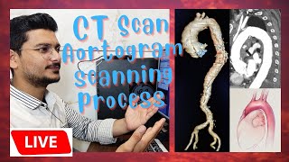 live CT Scan Aortogram scanning process and techniques  scanning process of Aortic Angiography [upl. by Akeimat953]