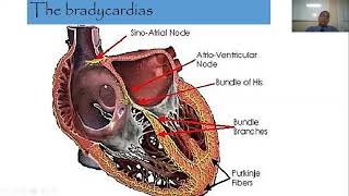 Cardiac Arrhythmias part1  Bradycardia [upl. by Euqinomahs871]