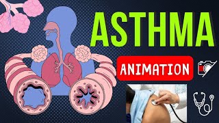 ASTHMA and NORMAL BREATHING  ANIMATION [upl. by Ahsha887]