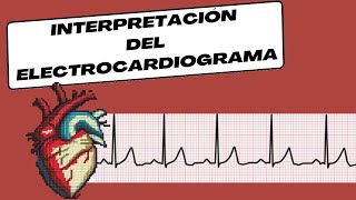 Interpretación del Electrocardiograma [upl. by Fabrice]