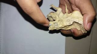 Temporal bone Part2Bangla tutorial [upl. by Parsaye]