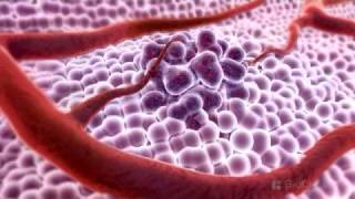 3D Medical Animation  What is Cancer [upl. by Tnairb]