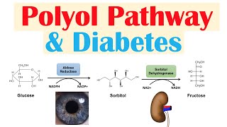 Polyol Pathway amp Diabetes  The Role of Polyol Pathway in Diabetes Pathogenesis [upl. by Nnyla358]