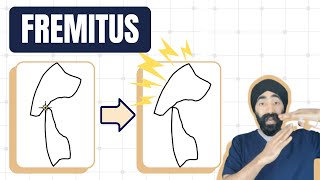 Fremitus and Occlusal Overload  Dental Occlusion Geekiness  PDP160 [upl. by Chemaram493]