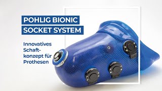 Pohlig Bionic Socket System PBSS  Innovatives Schaftkonzept für Oberschenkelprothesen [upl. by Franzoni385]