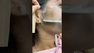 Permanent Upper Lips amp Facial Hair Removal Pack  Try This Homemade Wax hairremoval shorts viral [upl. by Yornek]