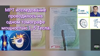 грыжа межпозвонкового диска L4 L5 один из случаев безоперационного лечения [upl. by Leandre263]