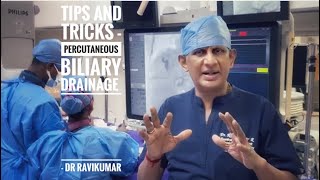 Percutaneous Biliary Drainage Tips and Tricks  Dr RaviKumar  ISVIR TNPY [upl. by Halimeda]