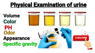 Physical Examination of urine part 2  PH and Specific gravity of urine [upl. by Ced]