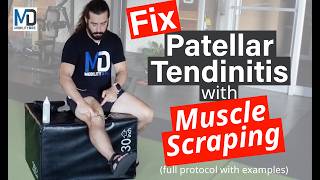 Full Muscle Scraping Protocol for Patellar Tendinitis  Gua Sha Routine [upl. by Fayola]