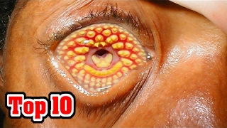 Top 10 Common Phobias You Probably Have [upl. by Eirac]