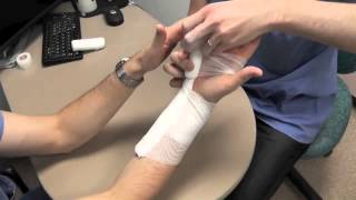 Ulnar Gutter Splint Howto [upl. by Eedahs]