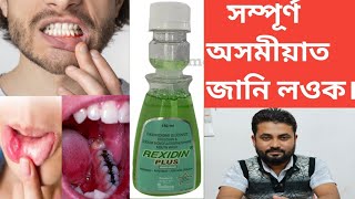 REXIDIN PLUS Mouthwash  Antiseptic  Anticaries Solution [upl. by Haeel768]