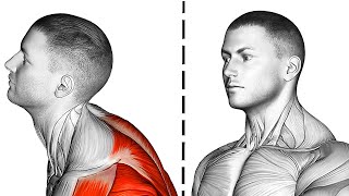 6 Exercises to Improve Forward Head Posture [upl. by Neeruam]