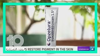 FDA approves cream to help those with vitiligo [upl. by Niwred]