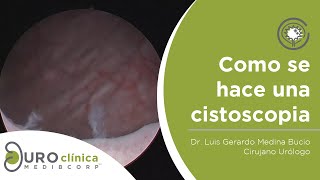 CISTOSCOPIA URETROSCOPIA DIAGNOSTICA [upl. by Sitoeht335]