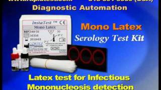 Mono Infectious Mononucleosis Serology kit [upl. by Alicirp]