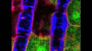 NIDCR Liver Vascular Flow [upl. by Anglo]