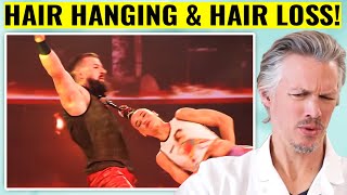 HAIR LOSS PERMANENT AGT PERFORMANCE LEADS TO HAIR LOSS FEARS [upl. by Ydnam]