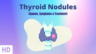 Thyroid Nodules Causes Symptoms and Treatment [upl. by Kitti]