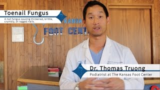 How to Get Rid of Toenail Fungus Effectively [upl. by Annod431]