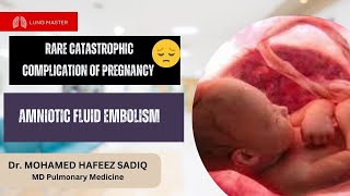 Amniotic Fluid Embolism [upl. by Nosydam]