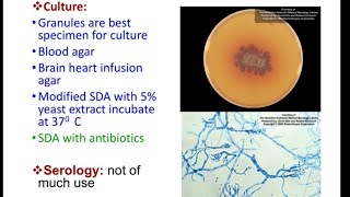 Subcutaneous Mycosis  mycetoma MICROBIOLOGY [upl. by Ennoved]