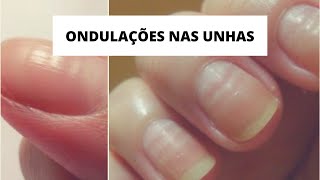 O QUE CAUSA ONDULAÇÕES NAS UNHAS  rafatododia [upl. by Scharaga]