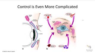 Online Seminar Art Epstein Dry Eye A Simple Approach to InDepth Understanding [upl. by Beverly]