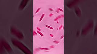 PSEUDOMONAS AUROGENOSA GRAM NEGATIVE BACILLI viral biology mlt viraltrend chemistrypathology [upl. by Enowtna]