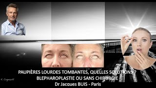 PAUPIERES LOURDES TOMBANTES  QUELLES SOLUTIONS  AVEC BLEPHAROPLASTIE OU SANS CHIRURGIE Dr BUIS J [upl. by Giliane]